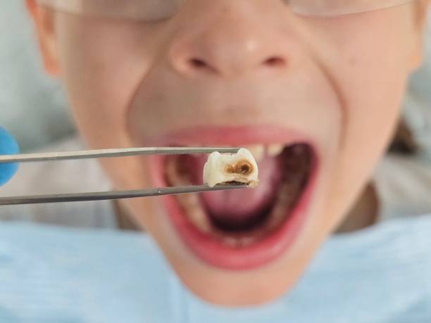 Best Emergency Treatment for Toothache in Ten Mile Run, NJ